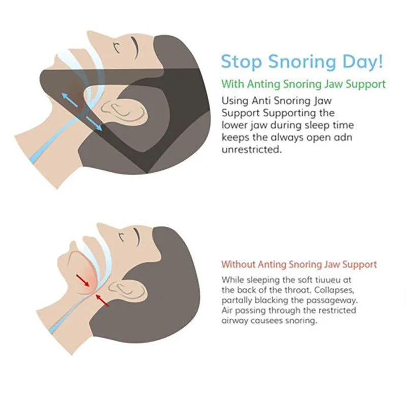 SleepWell Snore-Free Chin Strap